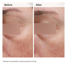 5% Face and Body Emulsion - Soft Balance