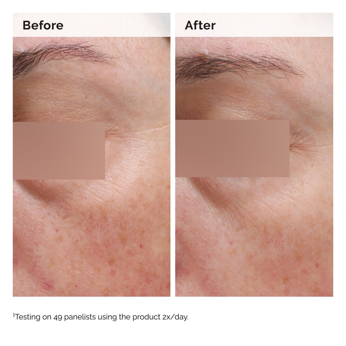 5% Face and Body Emulsion - Soft Balance