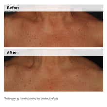 5% Face and Body Emulsion - Soft Balance
