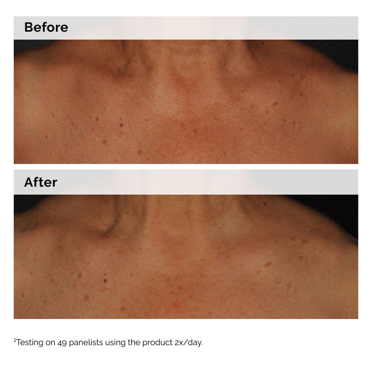 5% Face and Body Emulsion - Soft Balance