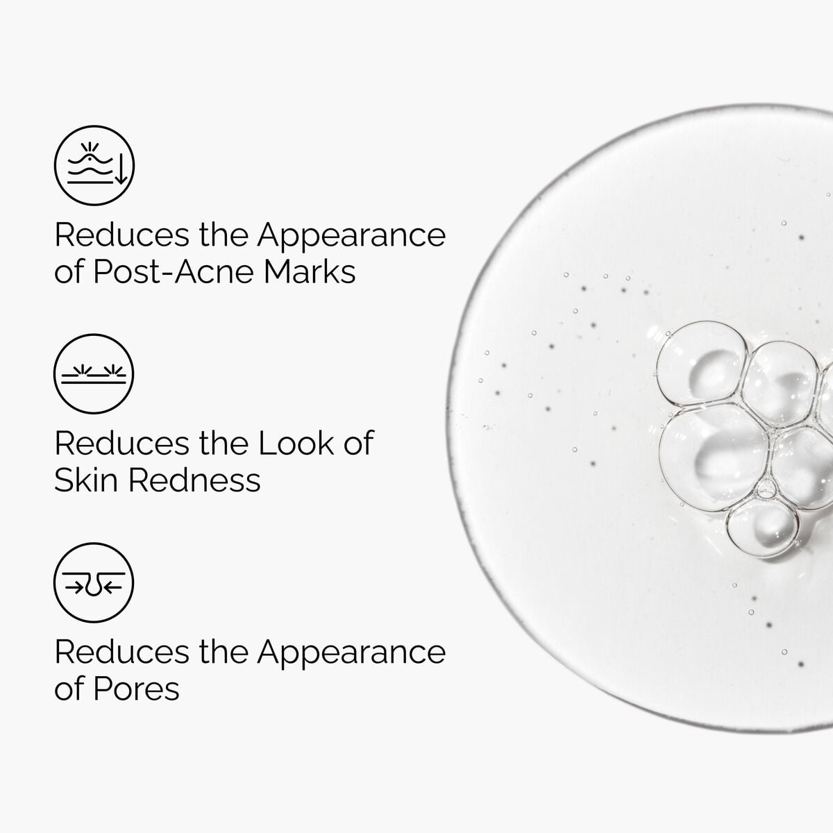 Aloe 2% + NAG 2% Solution - Clear Balance