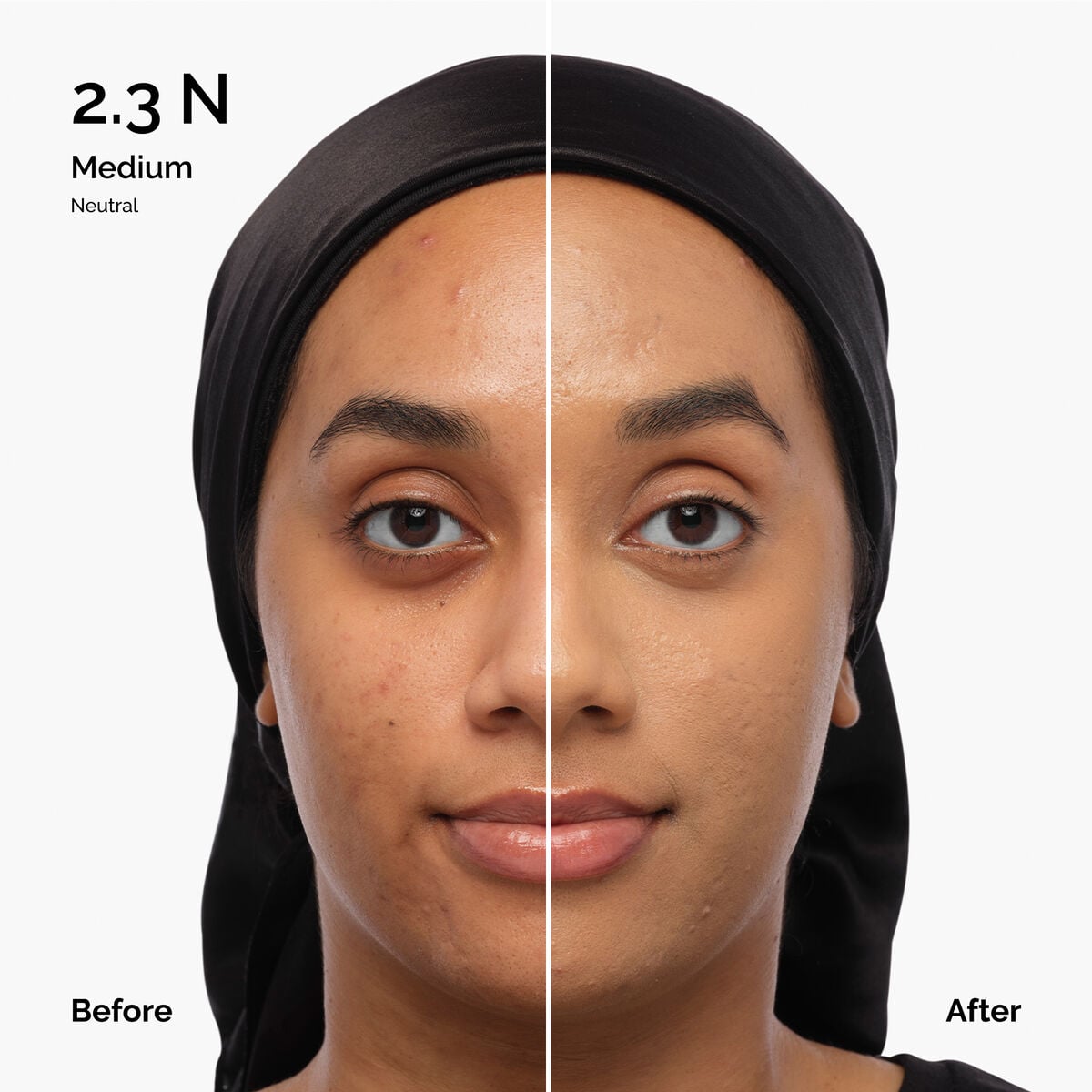 Serum - 1.0-n - 30ml - Bright Touch