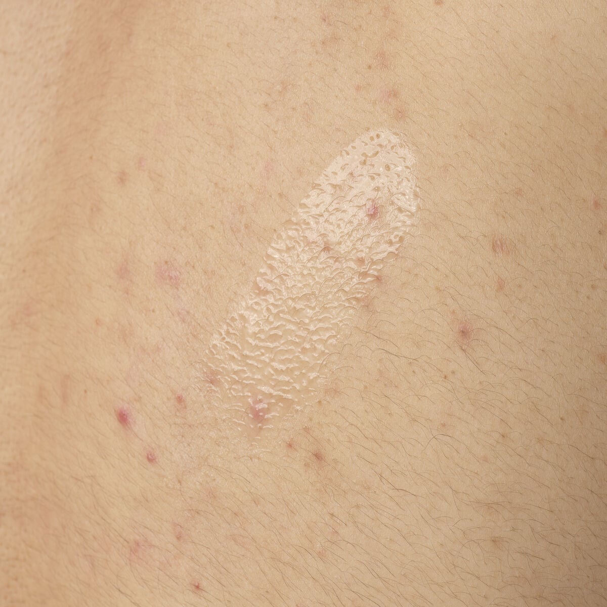 Acid 0.5% Body Serum - Soft Glam