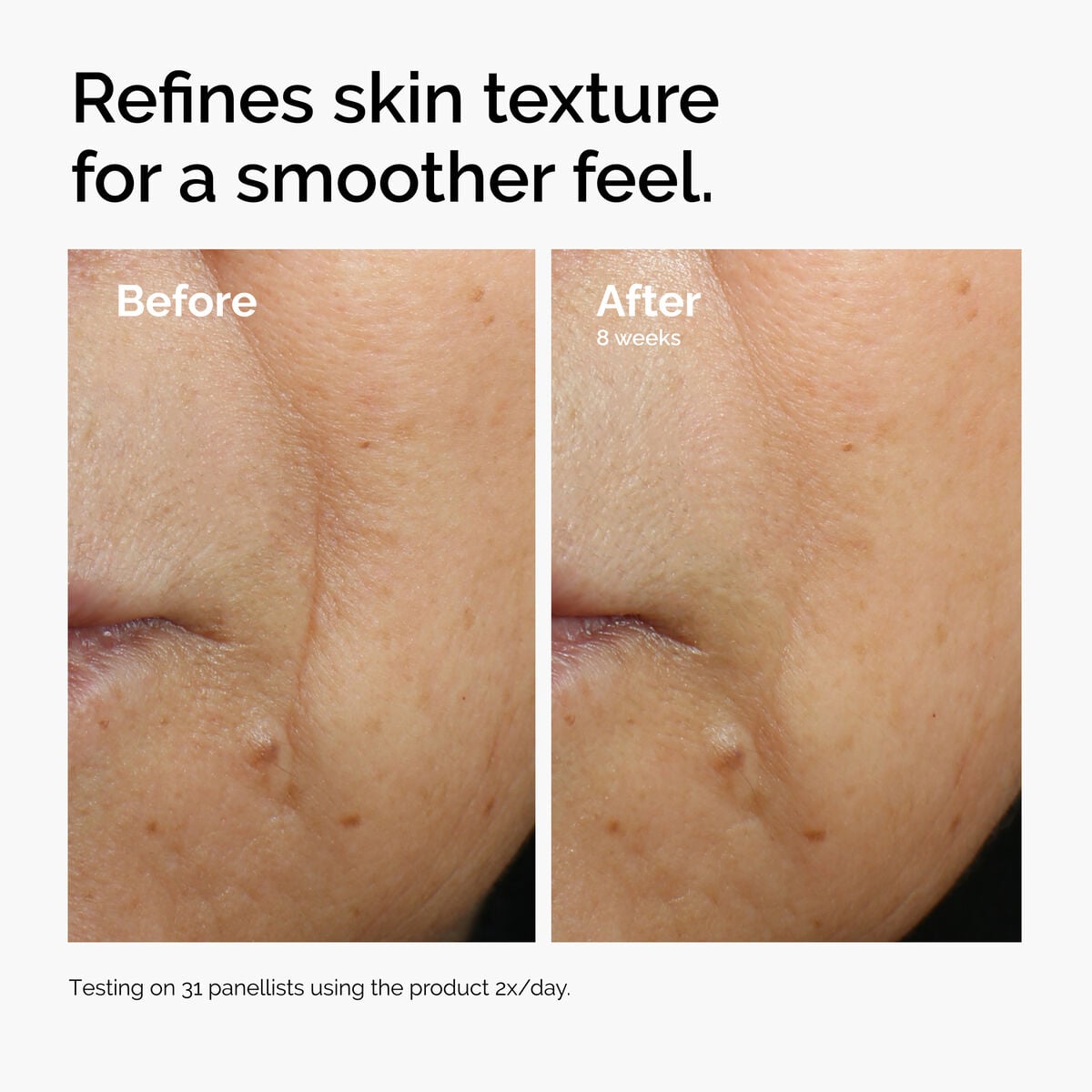 3% + Escin 1% Face Serum - Soft Balance