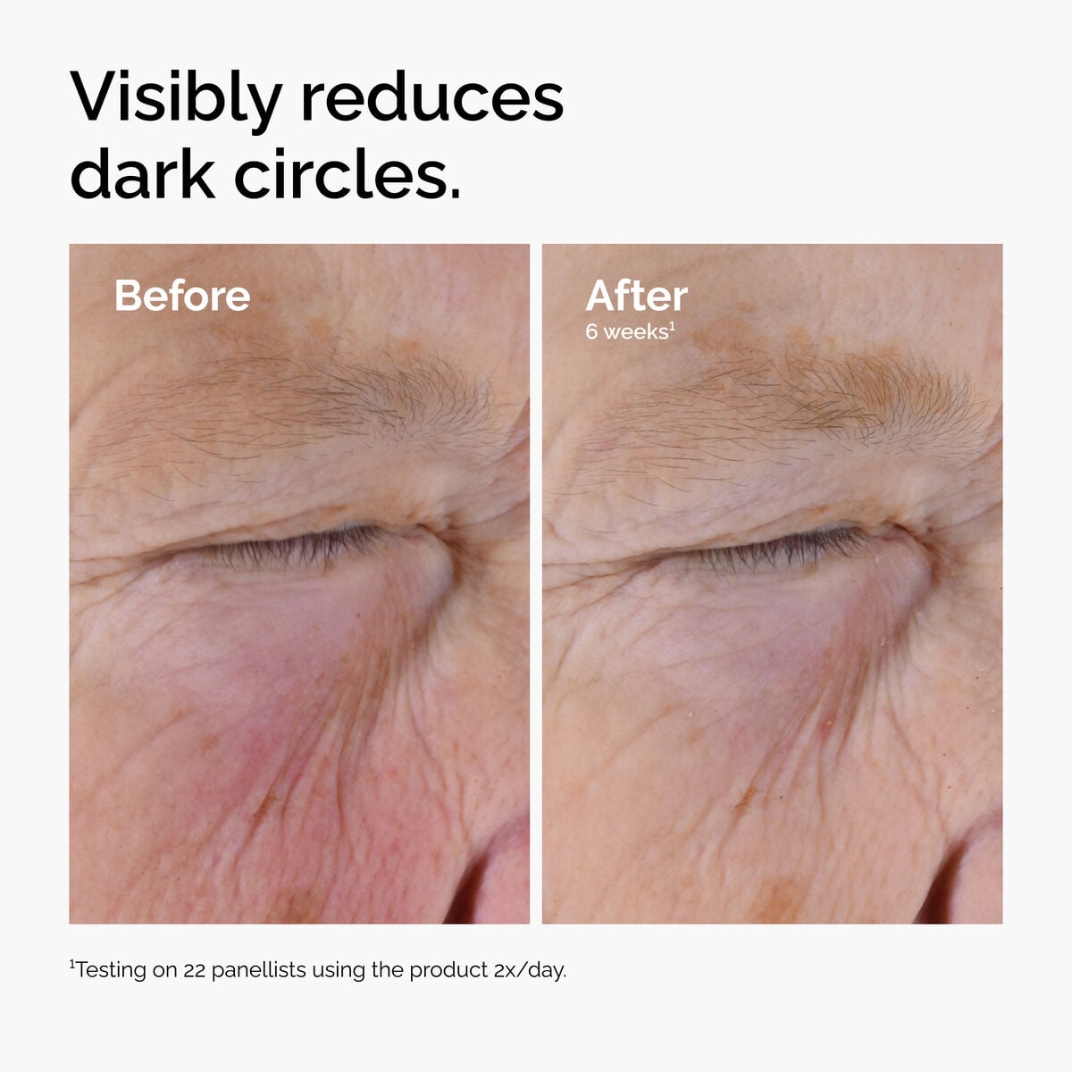 5% + EGCG Eye Serum - Simple Edit