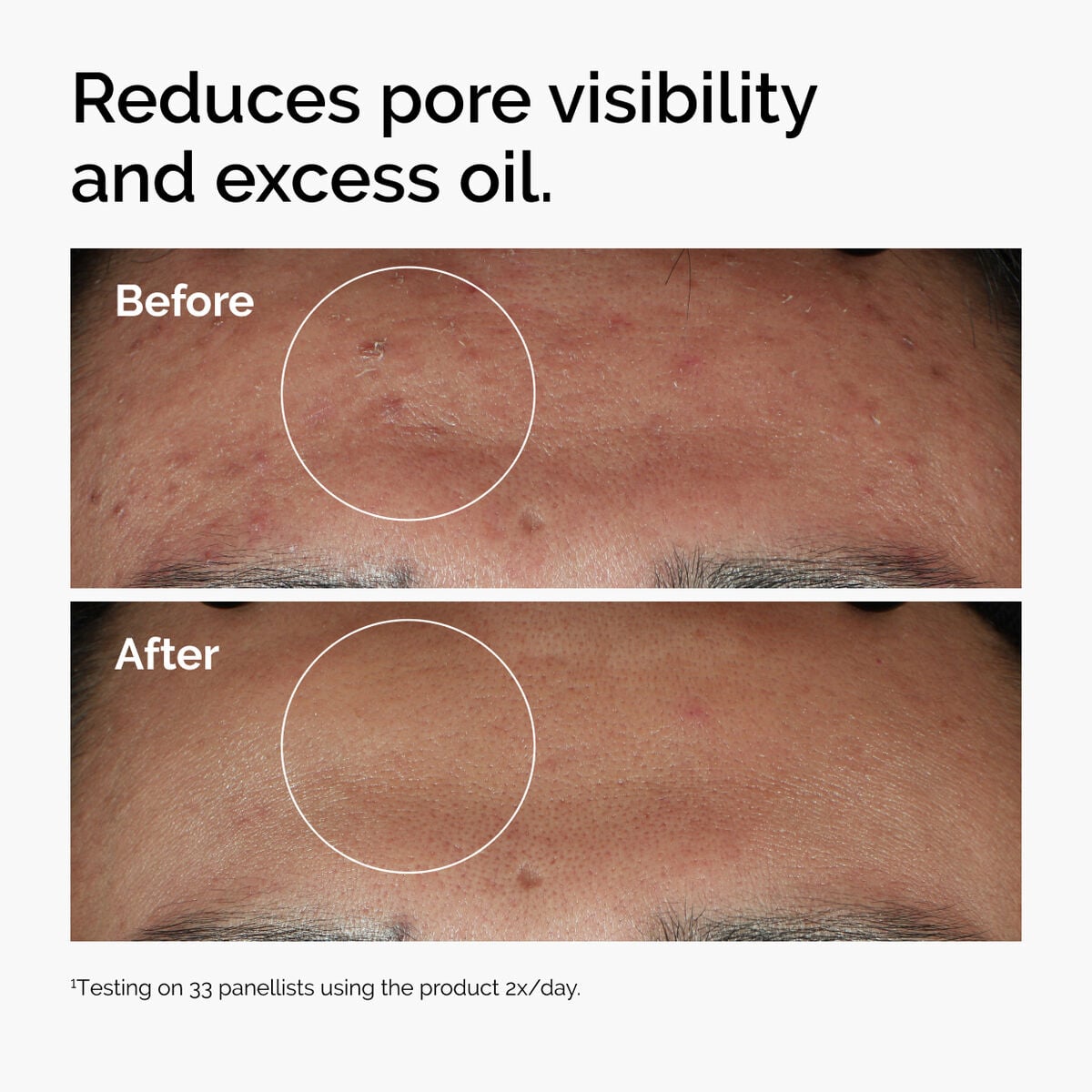 10% + Zinc 1% - Easy Routine