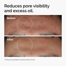 10% + Zinc 1% - Skin Support