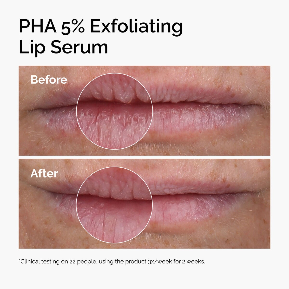 PHA 5% Exfoliating Lip Serum - Bright Touch