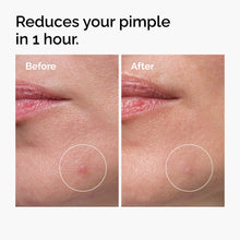 Sulfur 10% Powder-to-Cream Concentrate - Smooth Layer